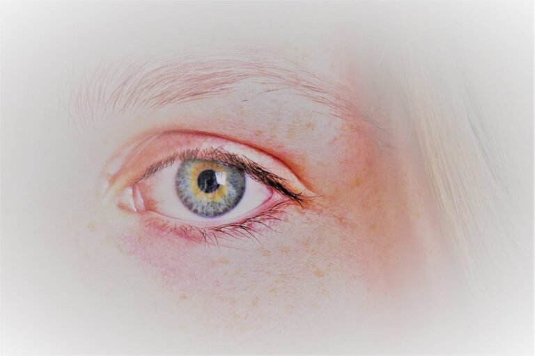 Natural Pink Eye